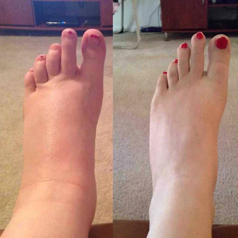 Lymphatic Drainage